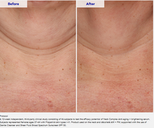 Load image into Gallery viewer, ZO Neck Complex (50mL) - Anti-Aging + Brightening Serum
