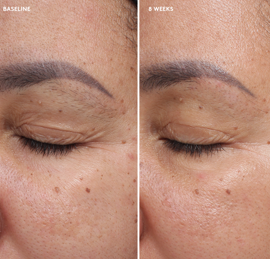 Colorescience Total Eye Firm & Repair